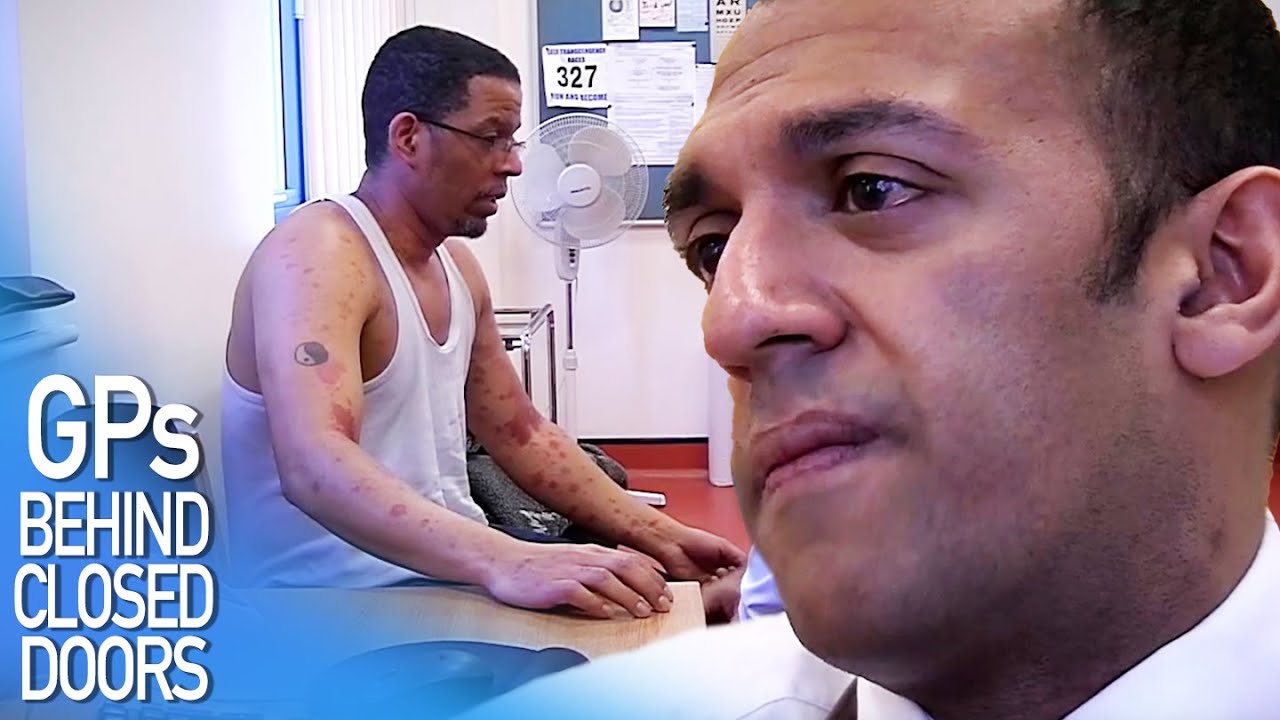 Skin Rash Caused By Stress | GPs: Behind Closed Doors