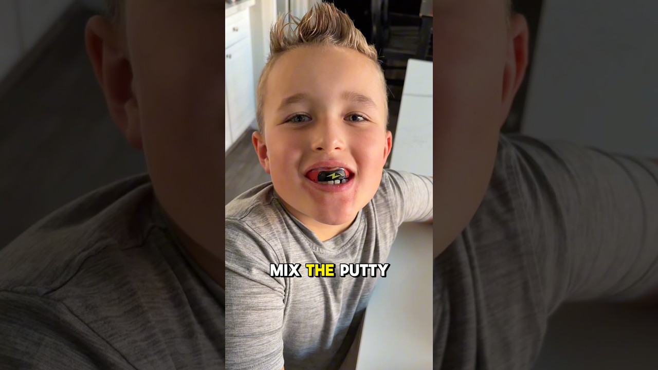 POV: Every young athlete&rsquo;s favorite mouthguard :)