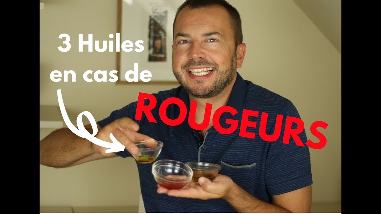 3 huiles v&eacute;g&eacute;tales anti-rougeurs