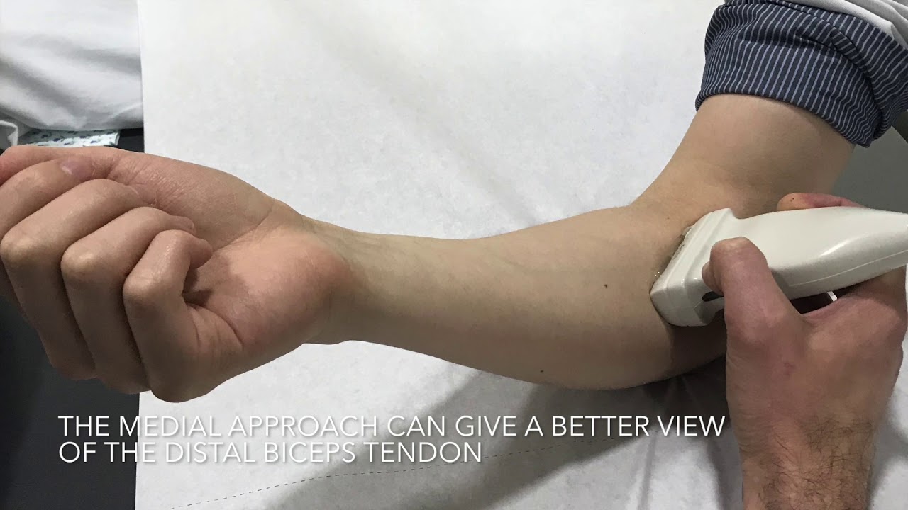 Elbow: distal biceps tendon approaches