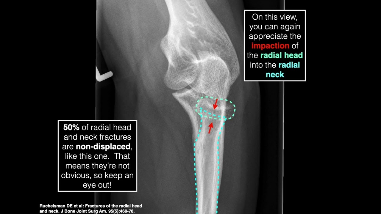 MSK Radiology series - Part 5