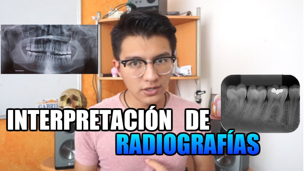 QUE PUEDO VER EN UNA RADIOGRAFIA DENTAL?