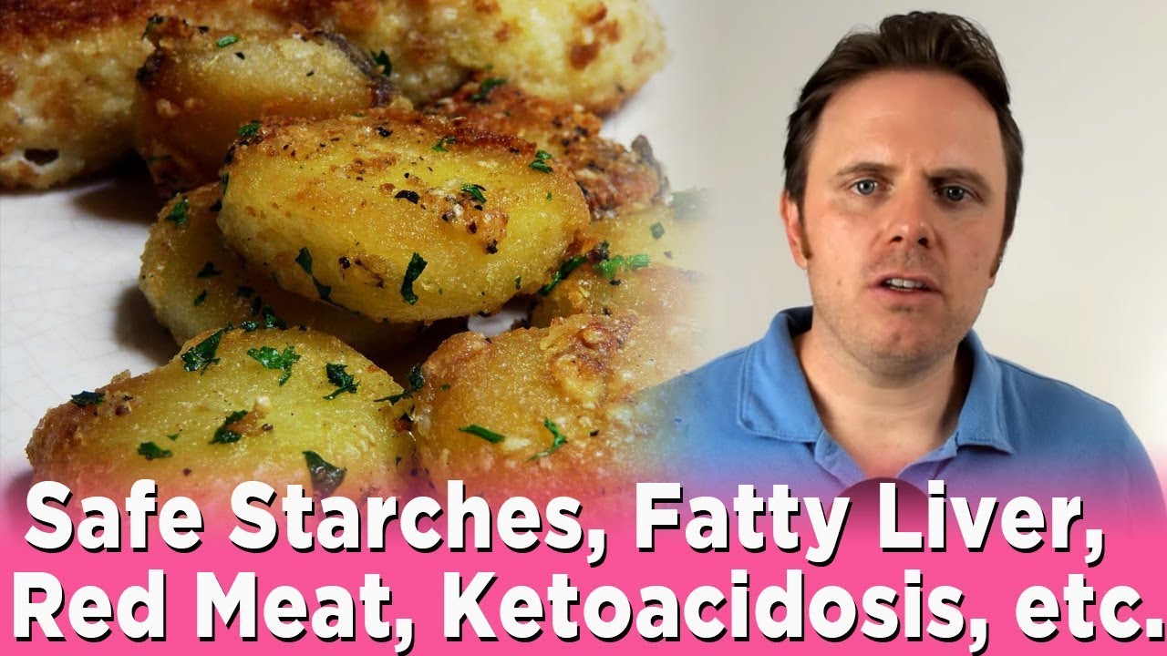 Safe Starches, Fatty Liver,  Red Meat, Ketoacidosis, etc.| Dr. J Q & A