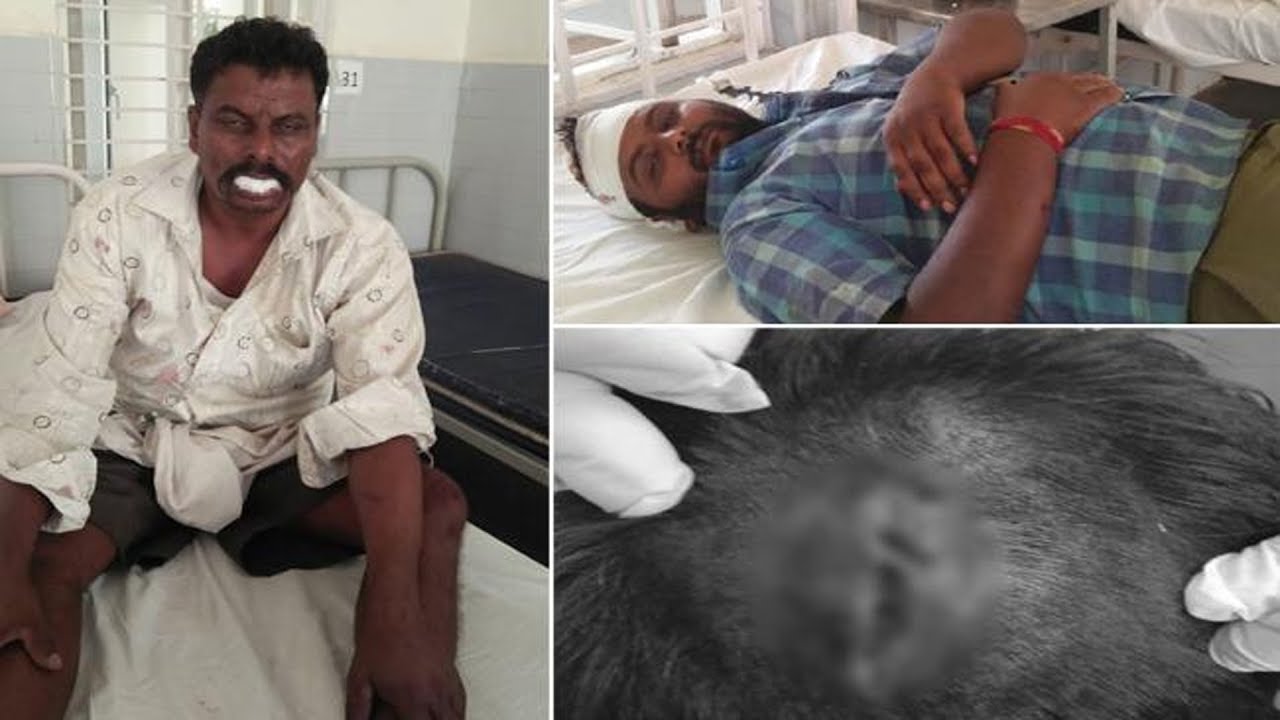 TDP Leaders And Activists Attacked On YSRCP Activists in Kuppam