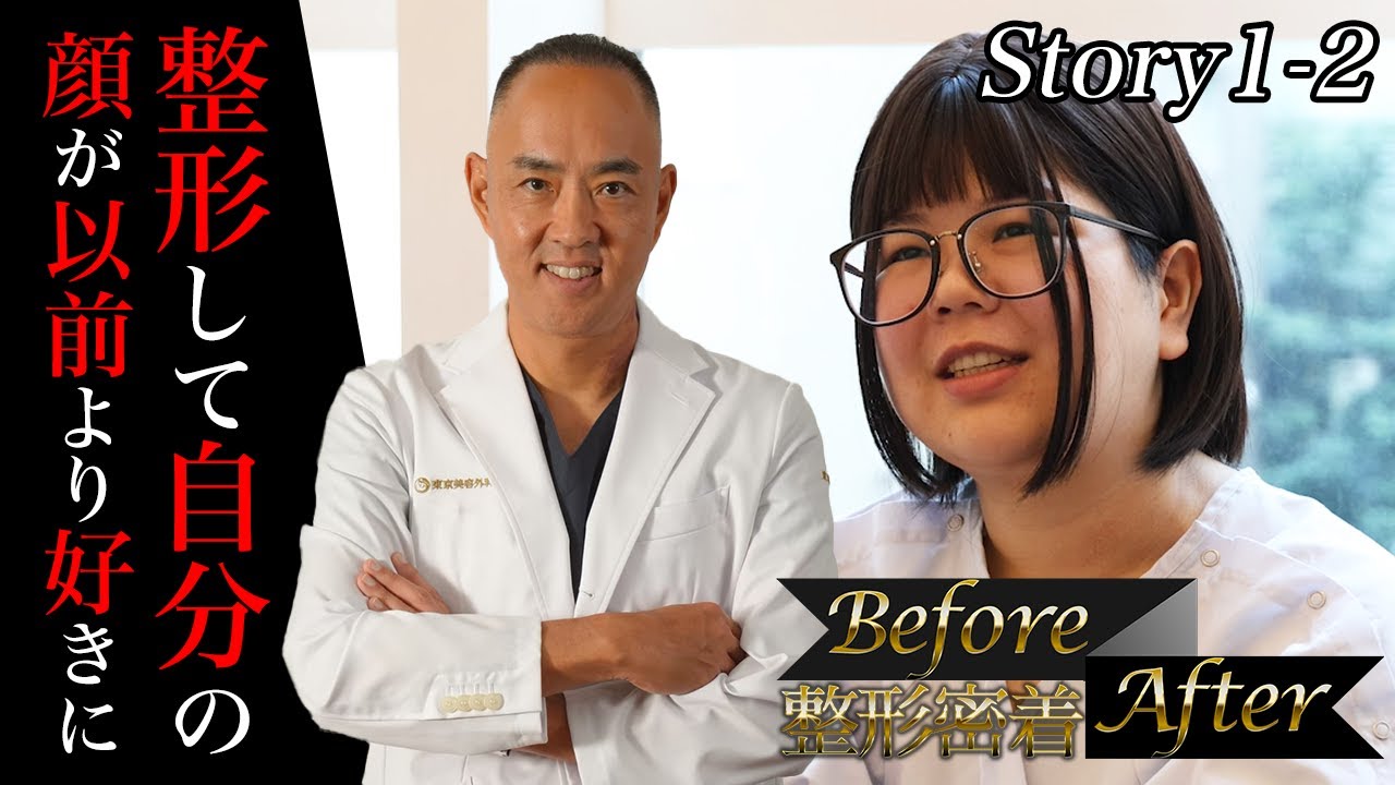 【整形密着BeforeAfter】整形して前より自分の顔が好きになった！全身プロデュース！今回は太ももの脂肪吸引と目元の脂肪注入【ドクターA（東京美容外科）】