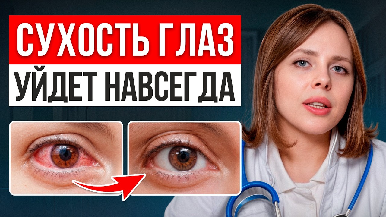 УБИРАЕМ синдром сухого глаза за 8 минут! / Простые СОВЕТЫ от врача!
