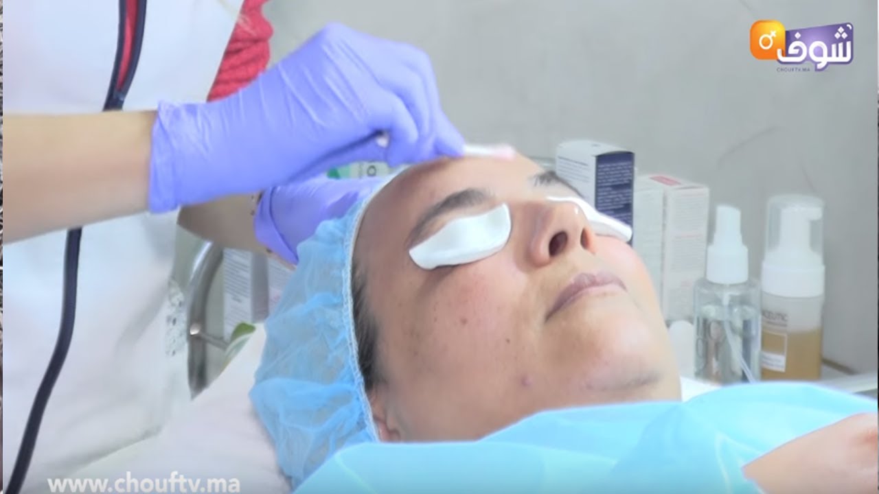 جديد عالم التجميل ..التقشير الكيميائي السطحي..الطريقة و الفوائد