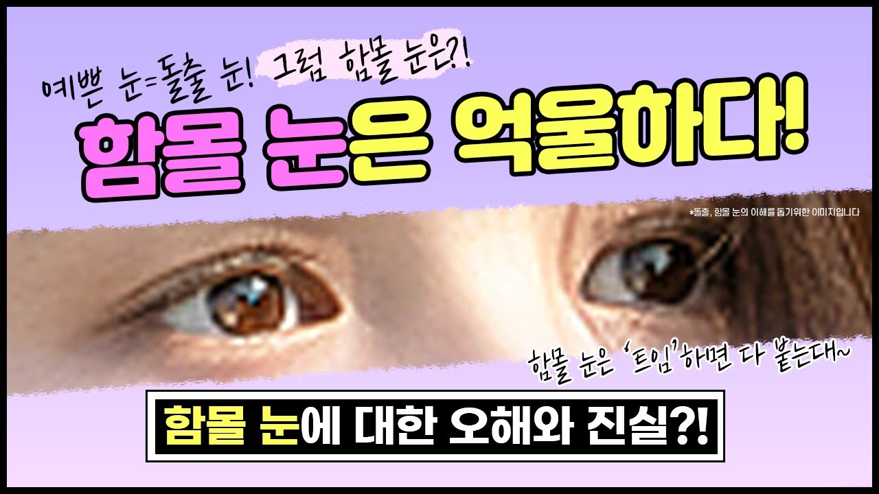 [눈성형] 함몰 눈은 쌍수하면 망한다?! 함몰눈성형 성공하는 해결방법은?!