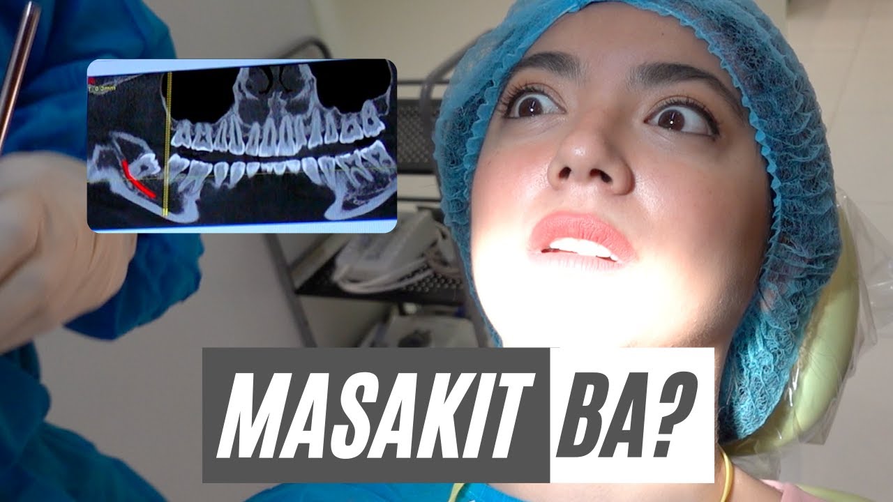 Wisdom Teeth Removal | #VLOGMAS | Crisha Uy