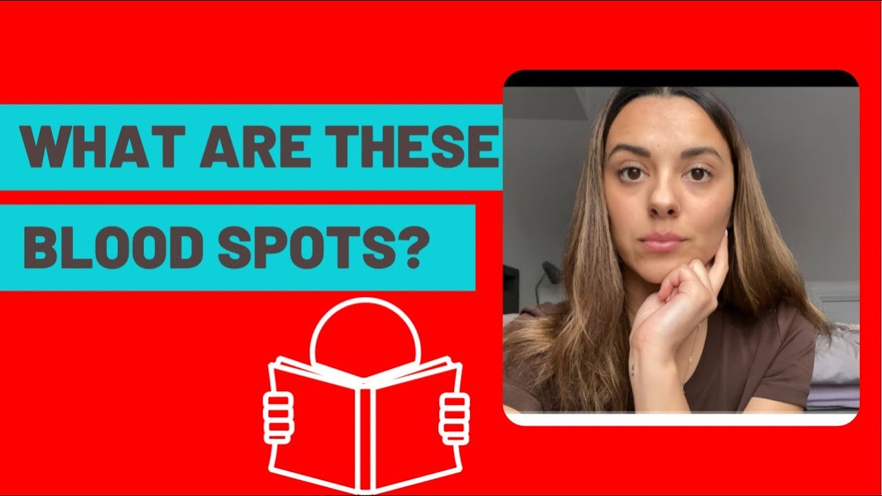 PETECHIAE (BLOOD SPOTS)