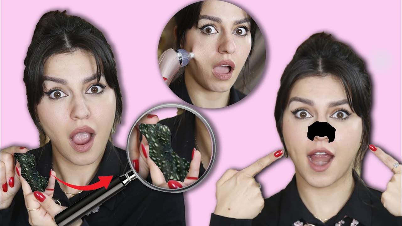 جربت خلطات جديدة لإزالة الرؤوس السوداء 👌😍 ... شوفوا البيض إيش عمل 😰😭 بوجهي