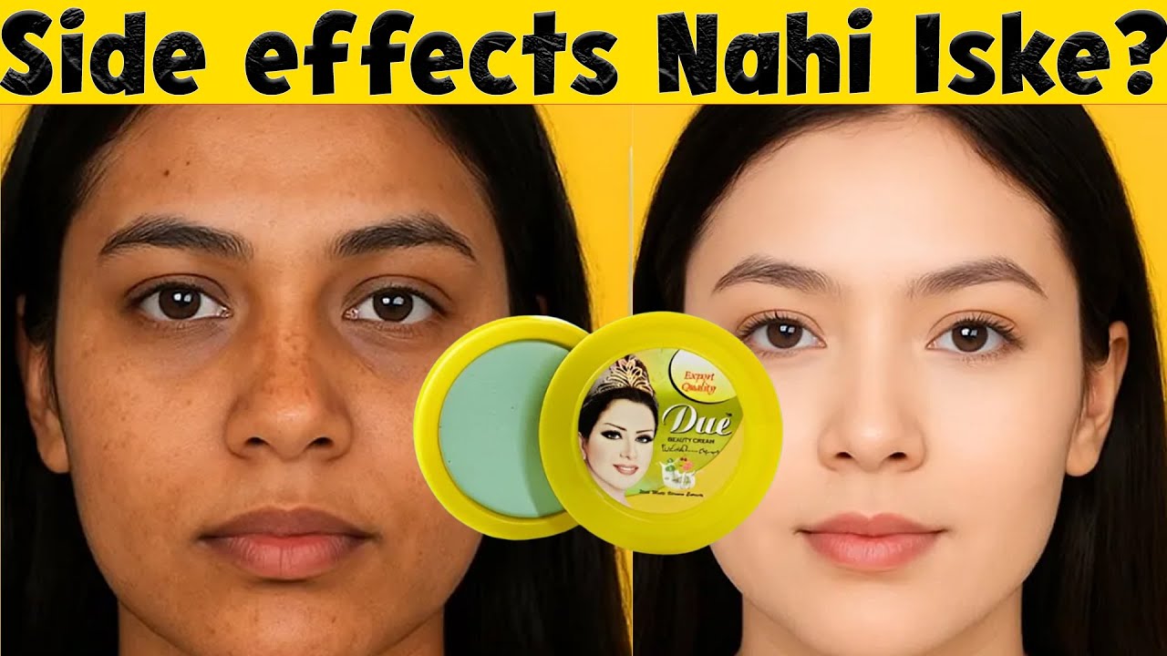 Due Beauty Cream Ka Sach!! Kya Yeh Skin Damage Karti Hai? Full Truth Exposed