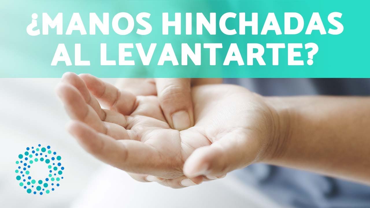 Manos HINCHADAS manos al DESPERTAR (8 Motivos) ✋ (Por qu&eacute; se me Hinchan las Manos cuando Duermo)