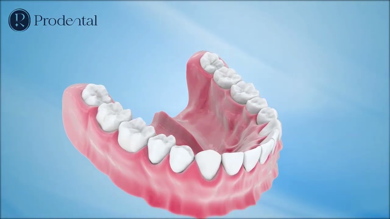 ✨ QUY TRÌNH HOÀN THIỆN RĂNG SỨ THẨM MỸ TẠI PRO DENTAL ✨
