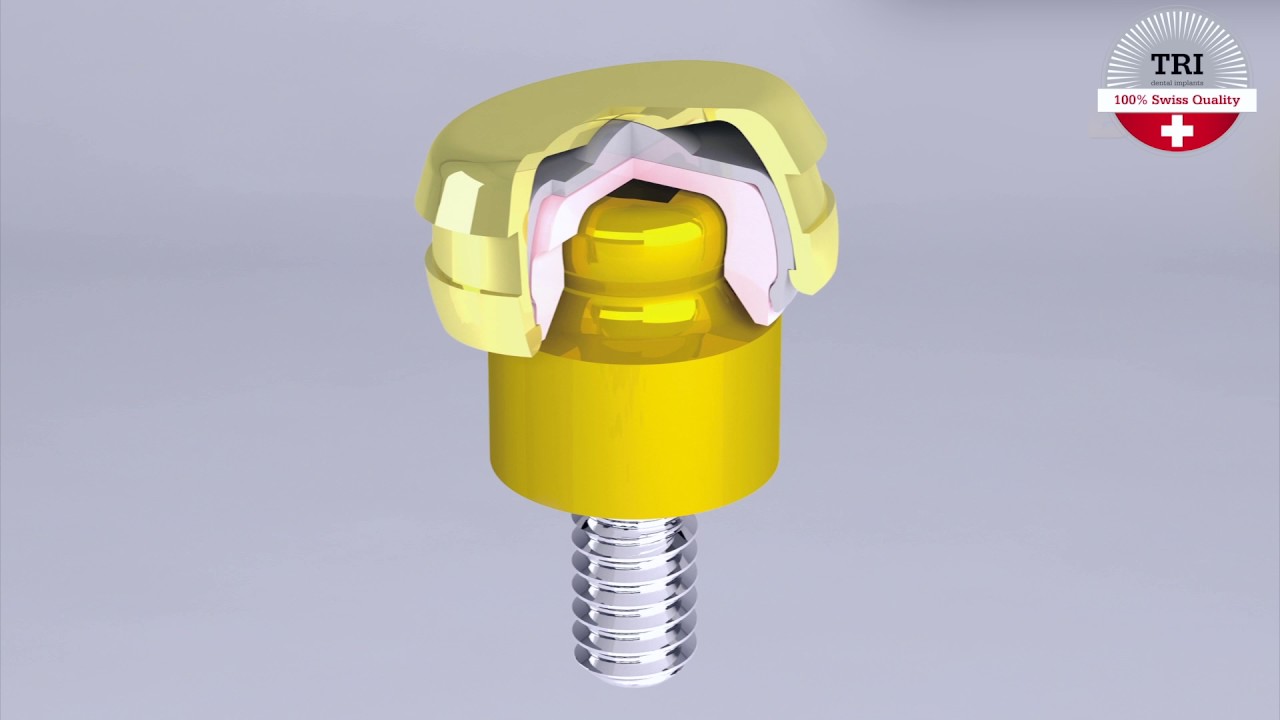 TRI® Raptor Overdenture Attachment System