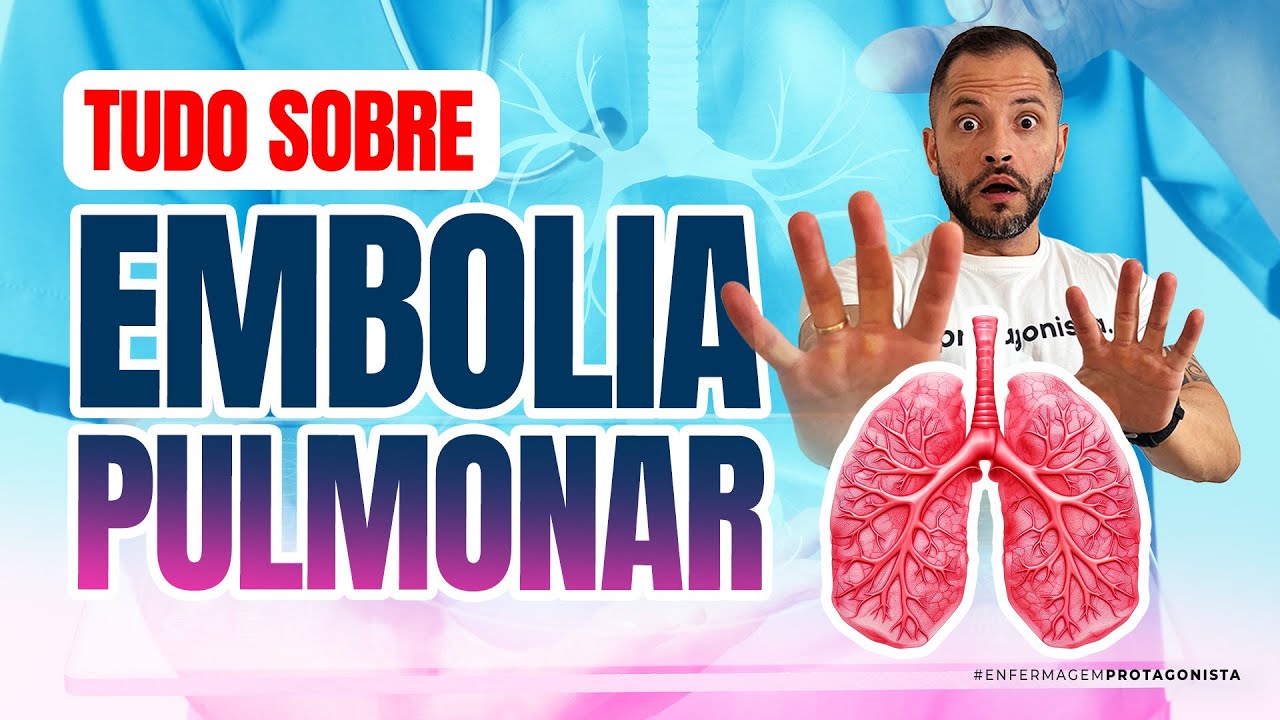 Tudo Sobre Embolia Pulmonar