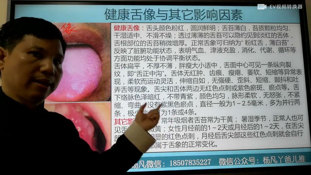 #52 舌诊提高课，带你走进神奇的舌诊世界  