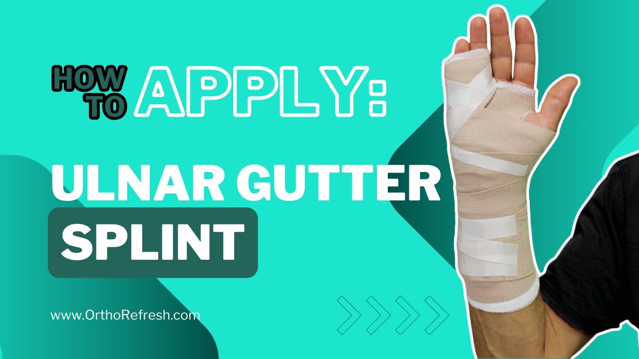How To Apply an Ulnar Gutter Splint for a broken hand / Boxer's Fracture