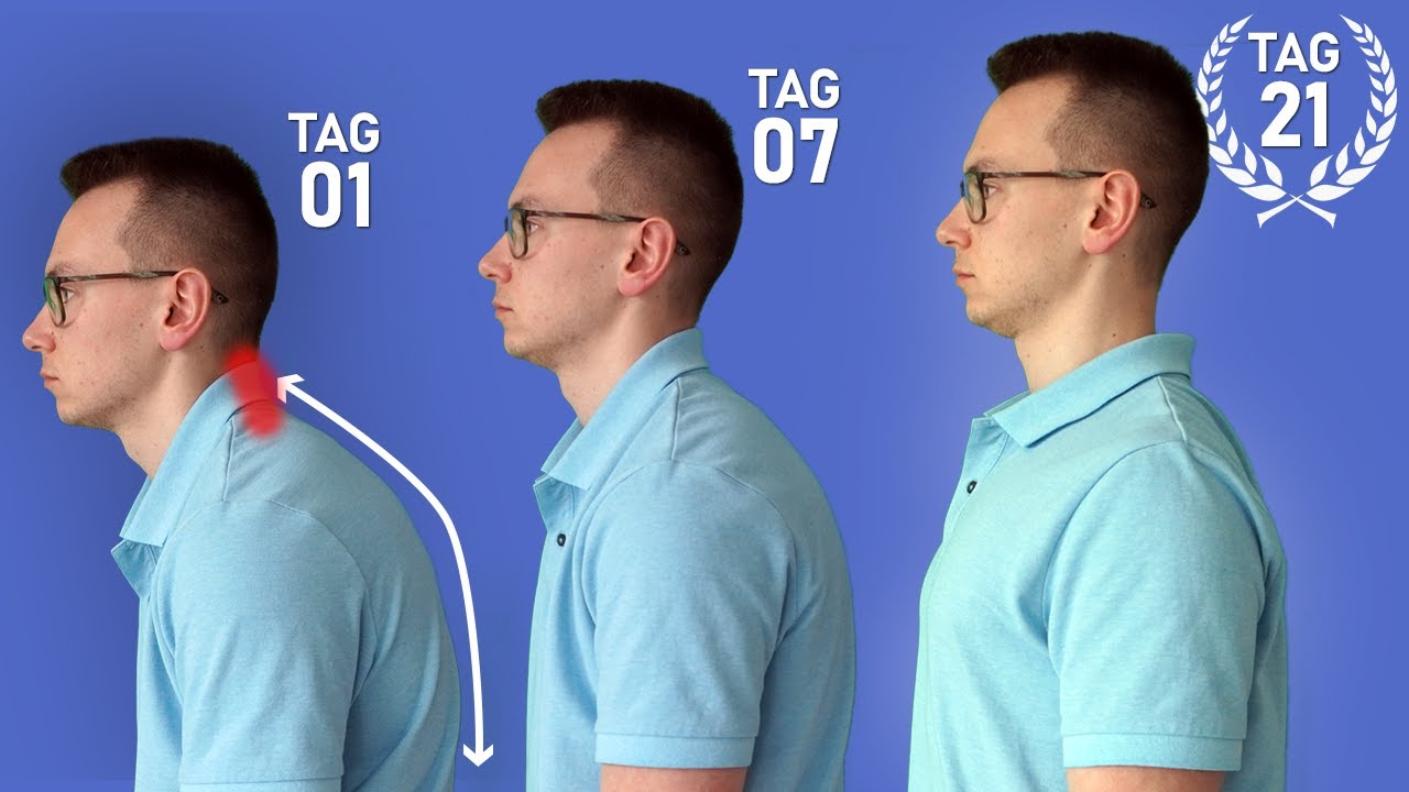 Wie du deinen Rundrücken loswirst (Gut für die Atmung)