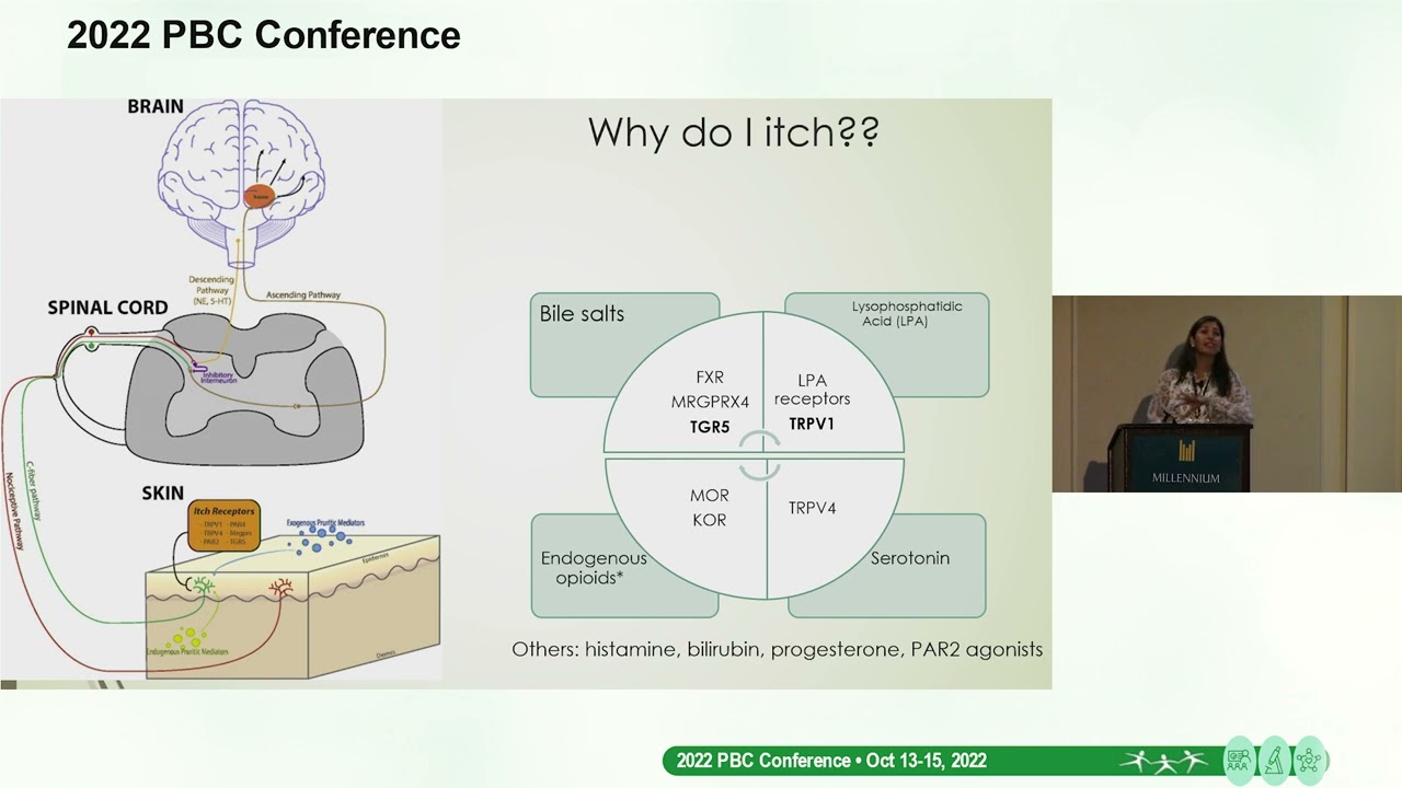 Cynthia Levy, MD   Topic  Dealing with PBC Itch