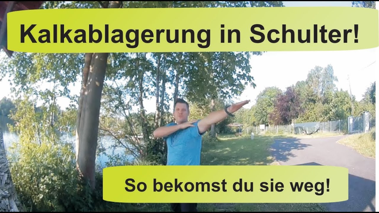 Kalkablagerung in der schulter, so bekommst du sie weg!