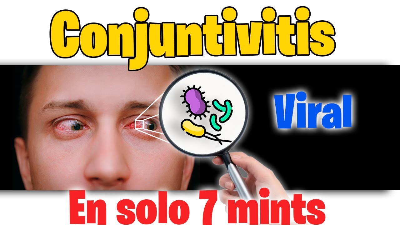 CONJUNTIVITIS VIRAL, Hemorr&aacute;gica ⚠️ MUY CONTAGIOSA