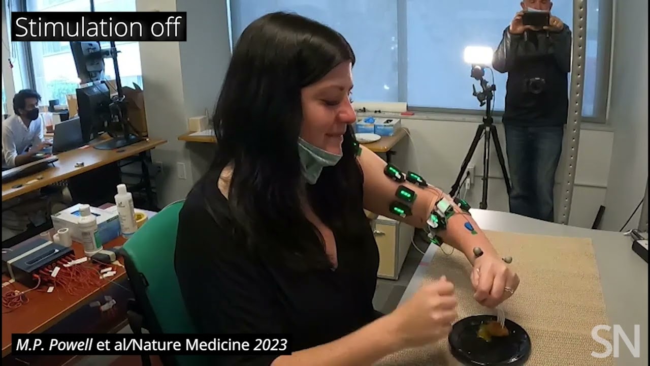 A new spinal implant lets a stroke patient regain arm motion | Science News