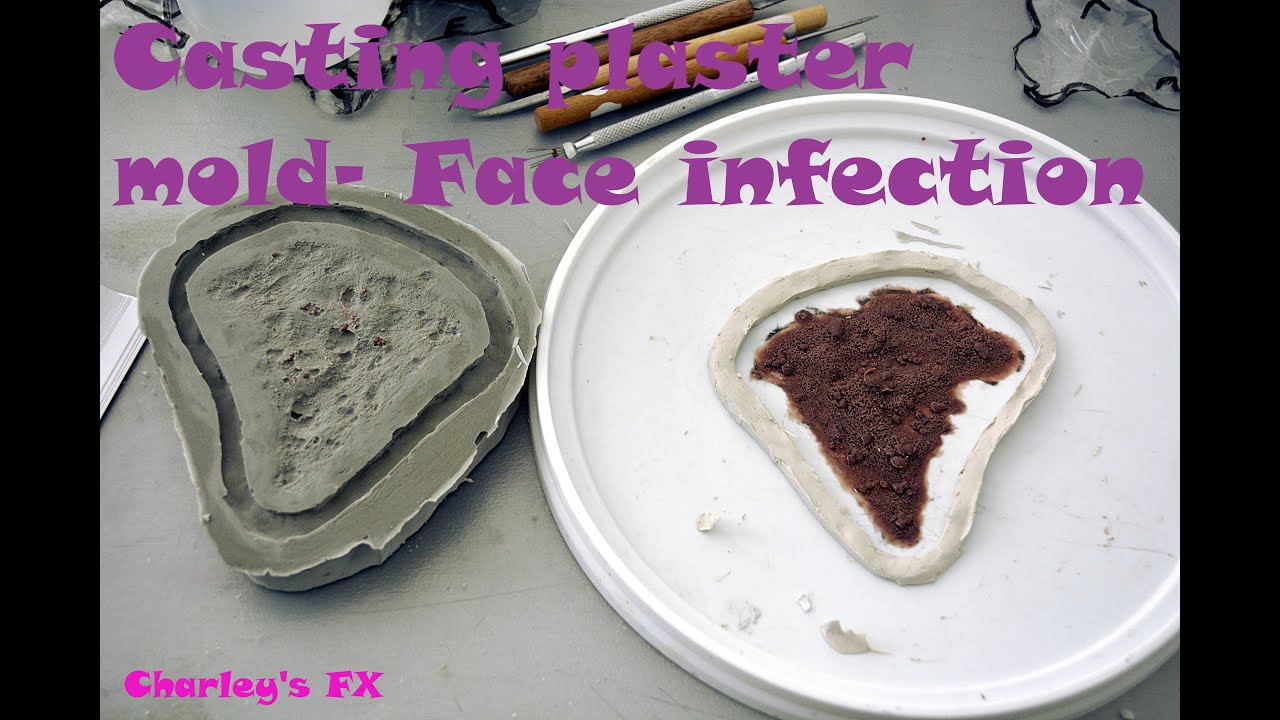 Casting a flat plaster mold -face infection prosthetics step 2