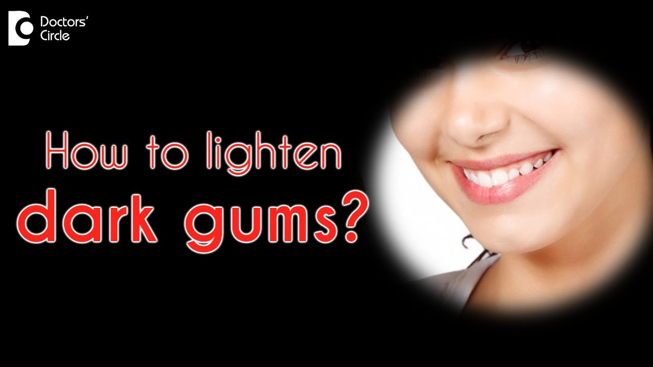 Ways to depigment dark gums in young girls - Dr.Ranjani Rao