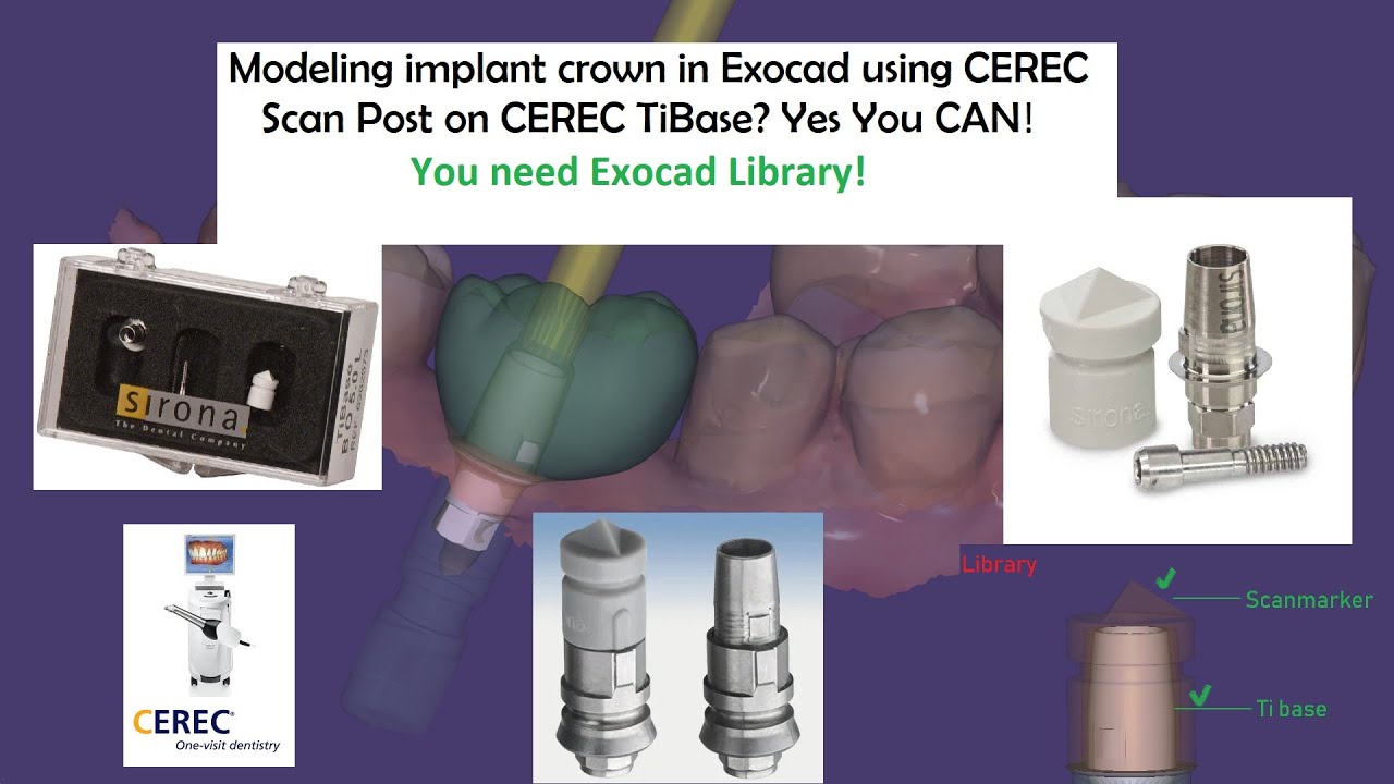 Sirona CEREC ScanPost and Cerec Tibase in Exocad: How to model crown or abutment?