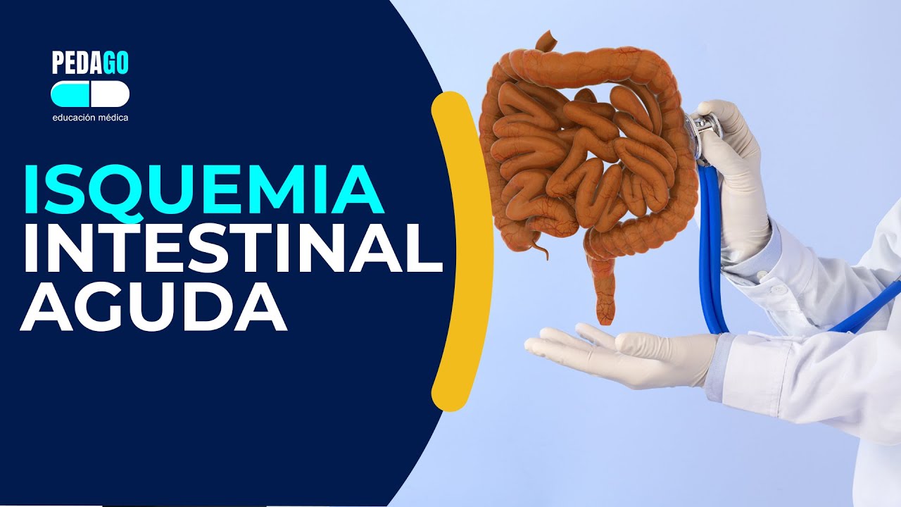 ISQUEMIA INTESTINAL AGUDA