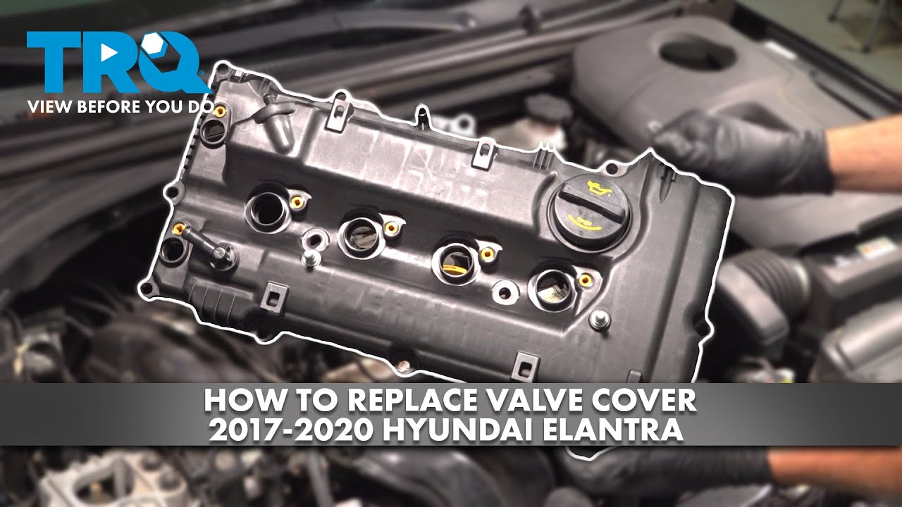 How to Replace Valve Cover 2017-2020 Hyundai Elantra