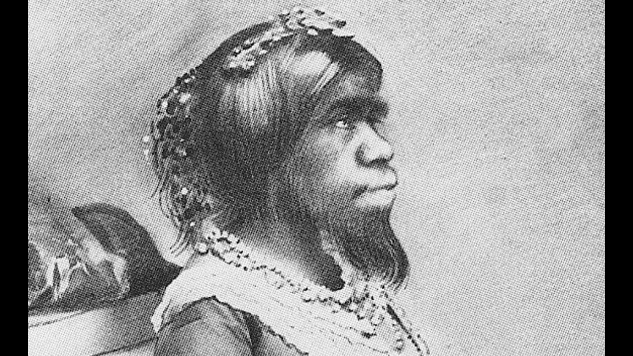 Julia Pastrana: Remembering Bearded Mexican Lady