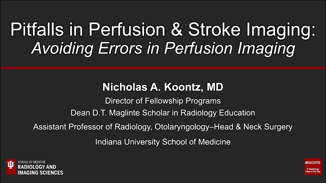 Pitfalls in Perfusion & Stroke Imaging: Avoiding Errors in Perfusion Imaging