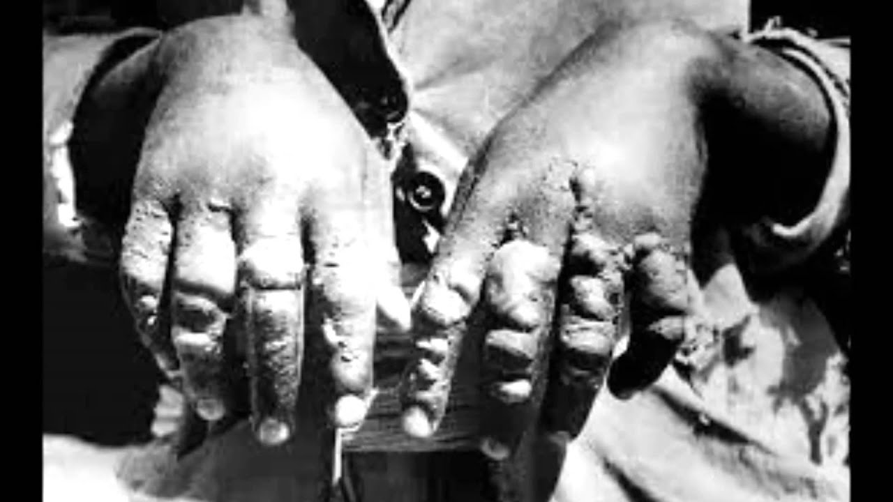 Erroro ዕሮሮ (በዶክተር ከበደ ሚካኤል)