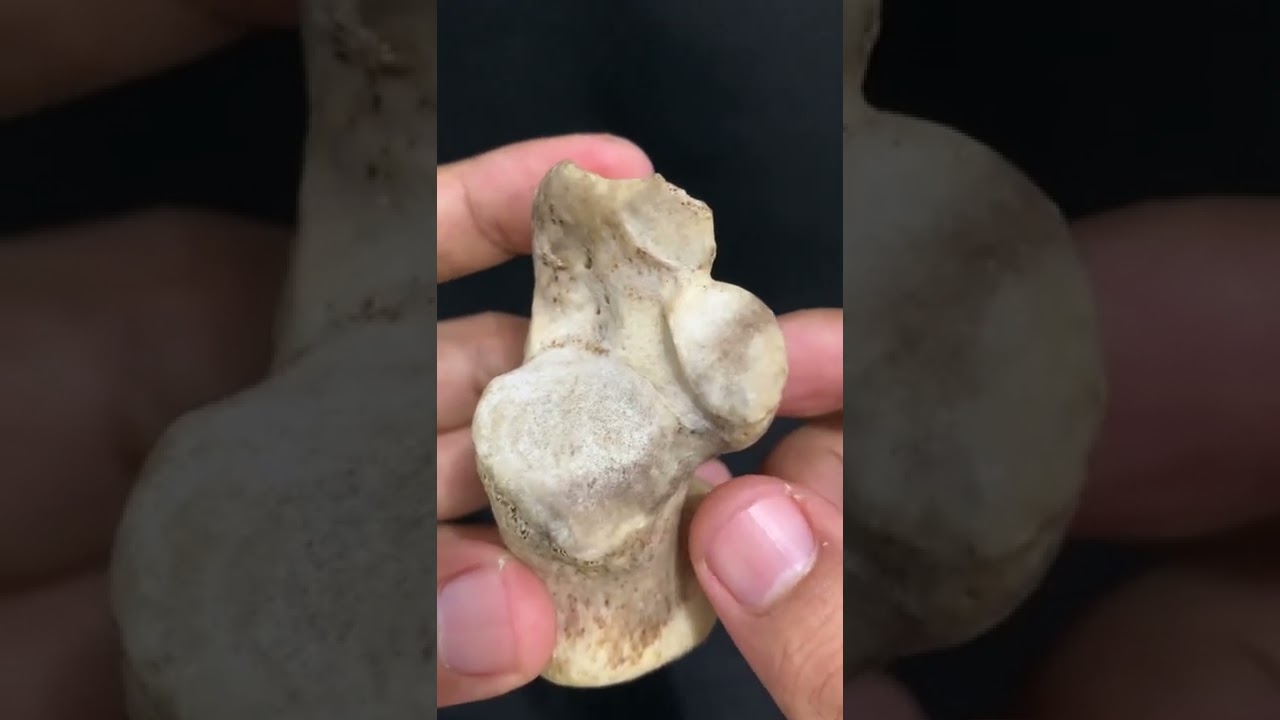 Osso calcâneo e seus detalhes
