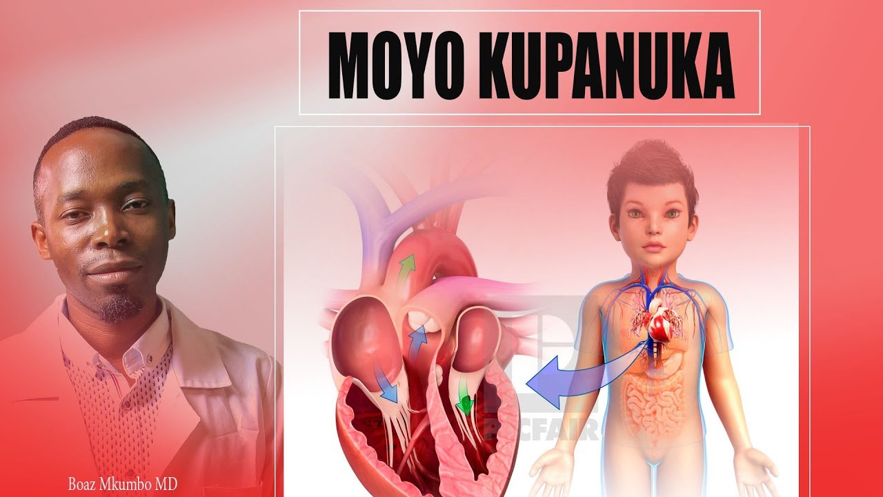 Dalili Kumi (10) zinazo ashiria Una Ugonjwa wa Moyo na Moyo Umepanuka. Part 1