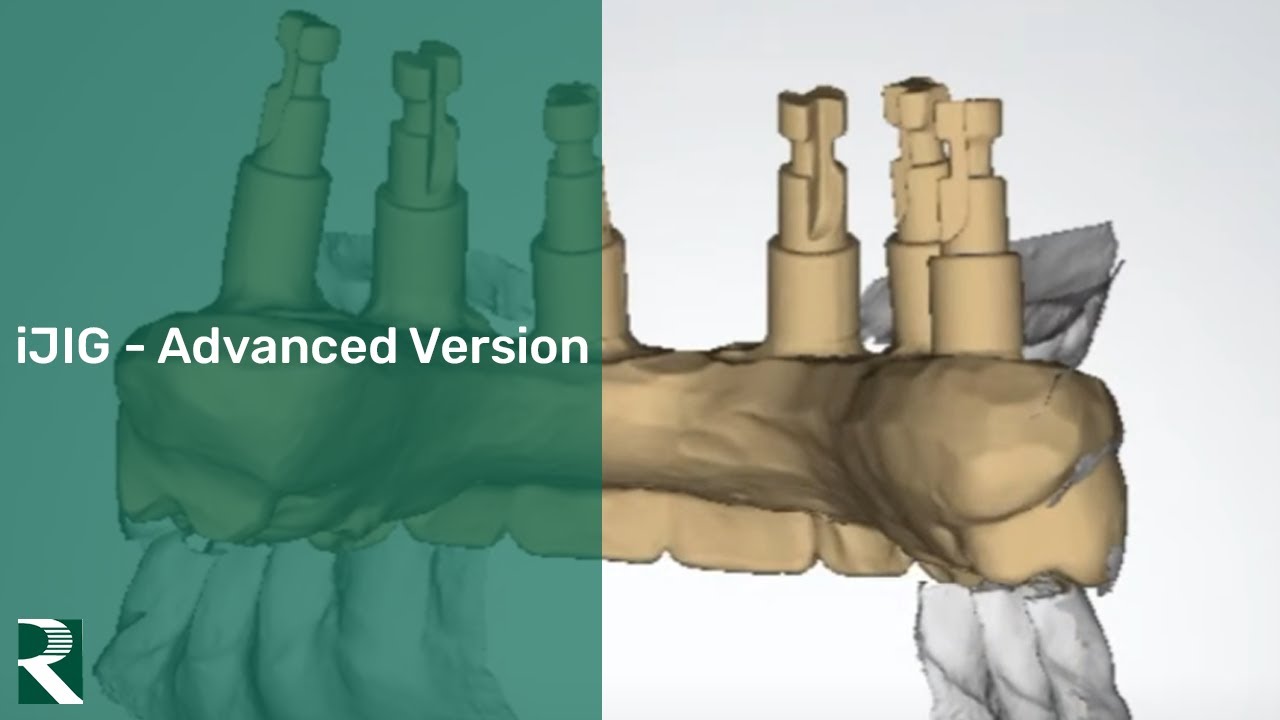 iJIG Plus New Advanced Version