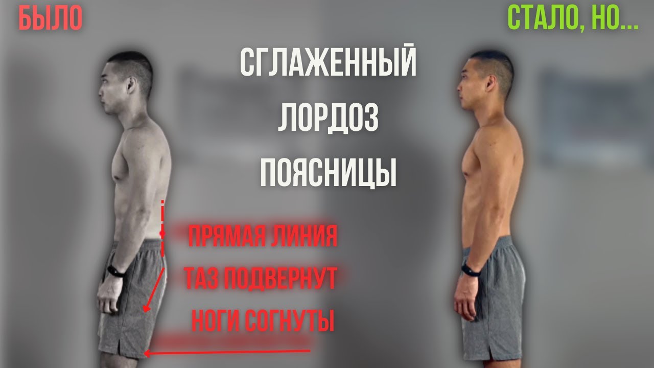Сглажен поясничный лордоз | Я 4 года занимался не правильно | Комплекс упражнений