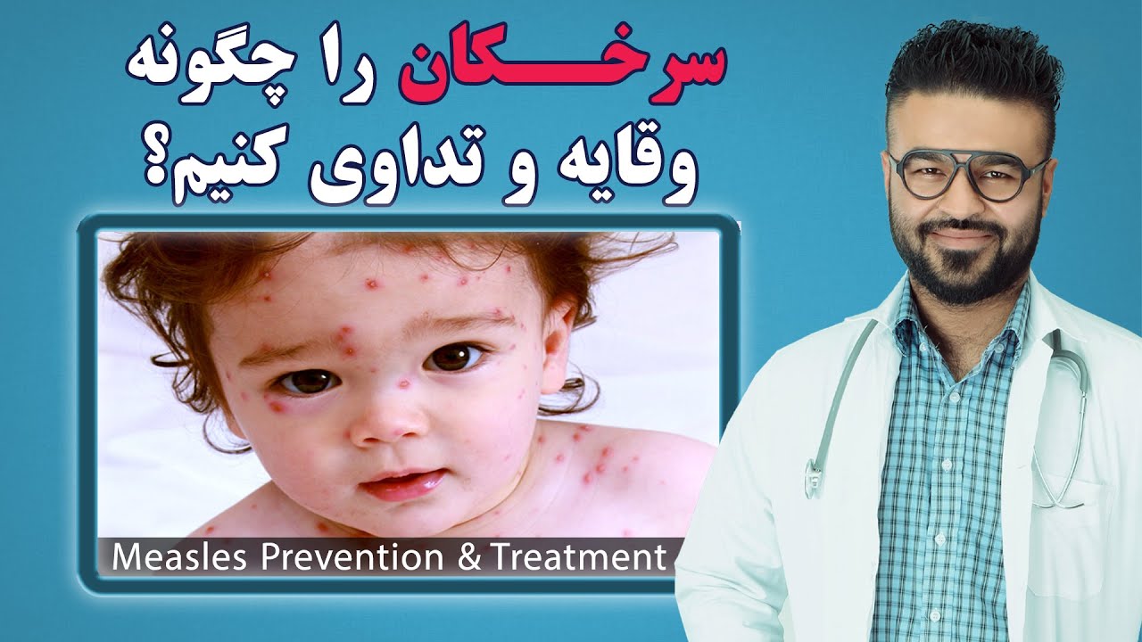 سرخـ/ـکان را چگونه وقایه و تداوی کنیم؟| داکتر قیس نیکزاد