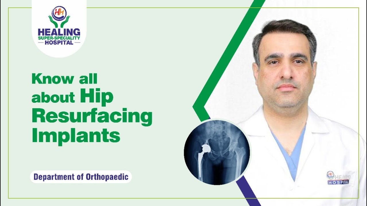 Know all about Hip Resurfacing Implants | Best Hospital in Chandigarh