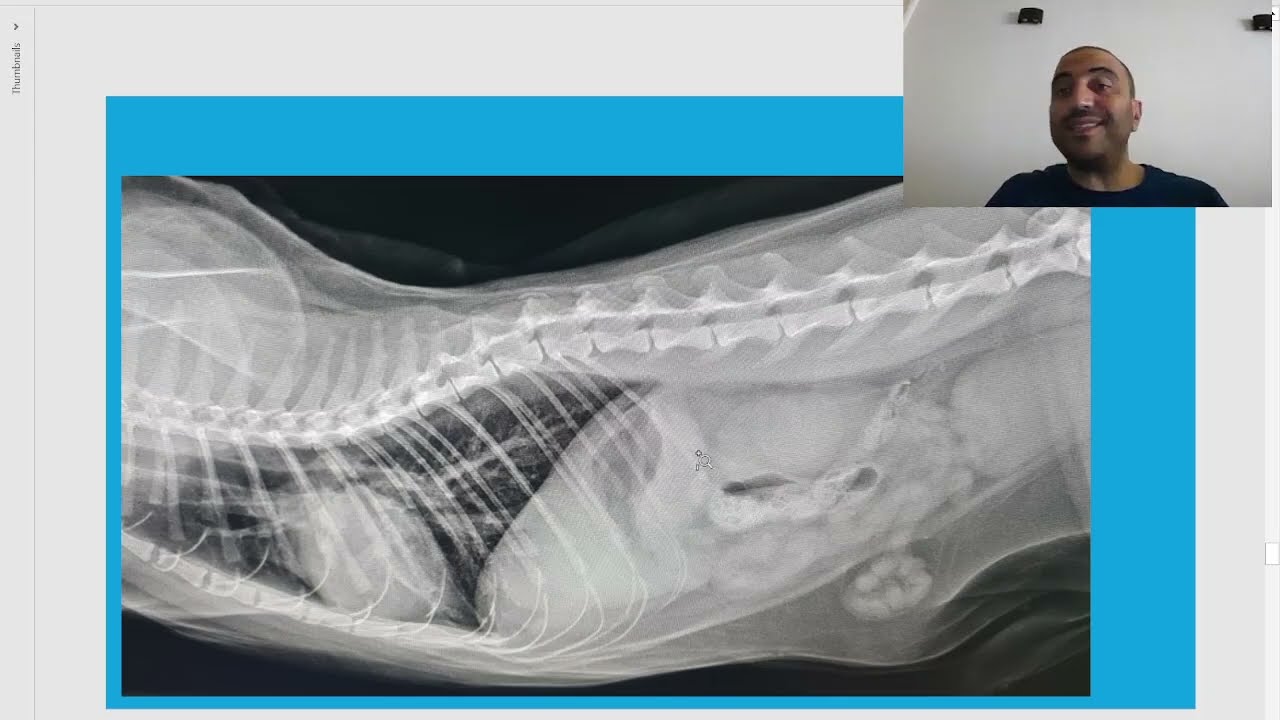 Chapter 13 mini clinical: معندوش dental or heart or hernia