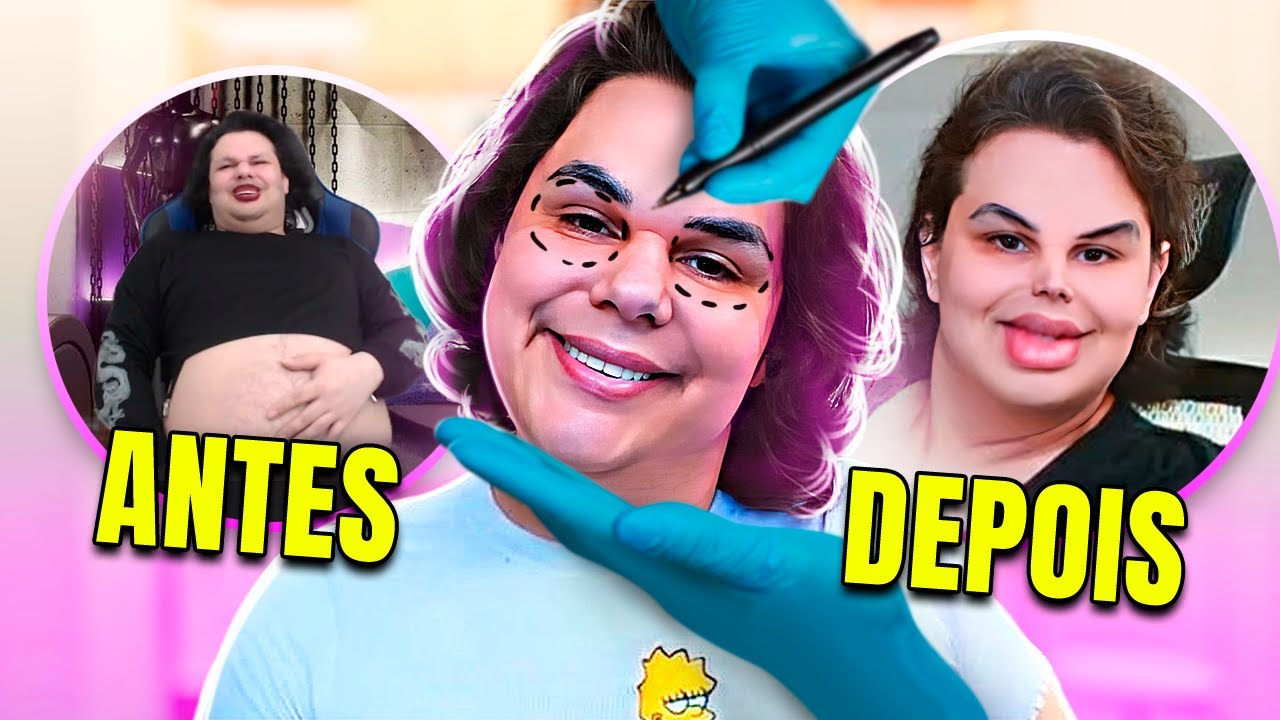 Tudo sobre MINHAS PLÁSTICAS e CIRURGIAS 👨‍⚕️💉