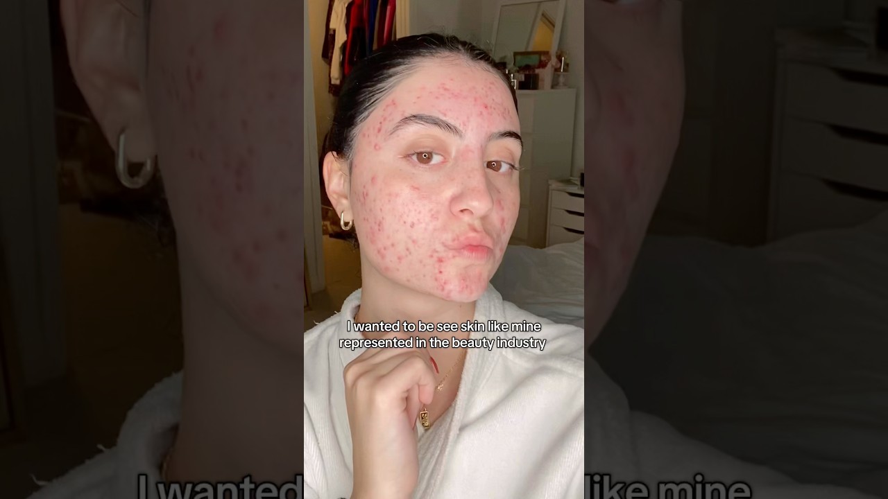 Я хотела представить кожу, похожую на мою, в индустрии красоты 💗🥰 