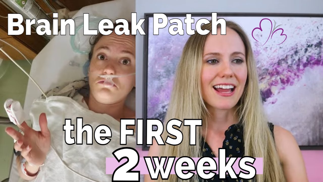 Blind BLOOD PATCH RECOVERY // Part 1: Procedure Day through 2 weeks Post-Op! (*see pinned comment)
