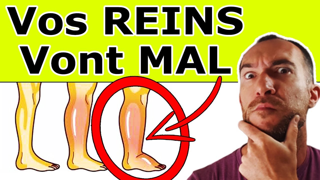 REINS MALADES : 9 SYMPT&Ocirc;MES Qui Doivent VOUS Alerter | Maladies R&eacute;nales & Insuffisance R&eacute;nale
