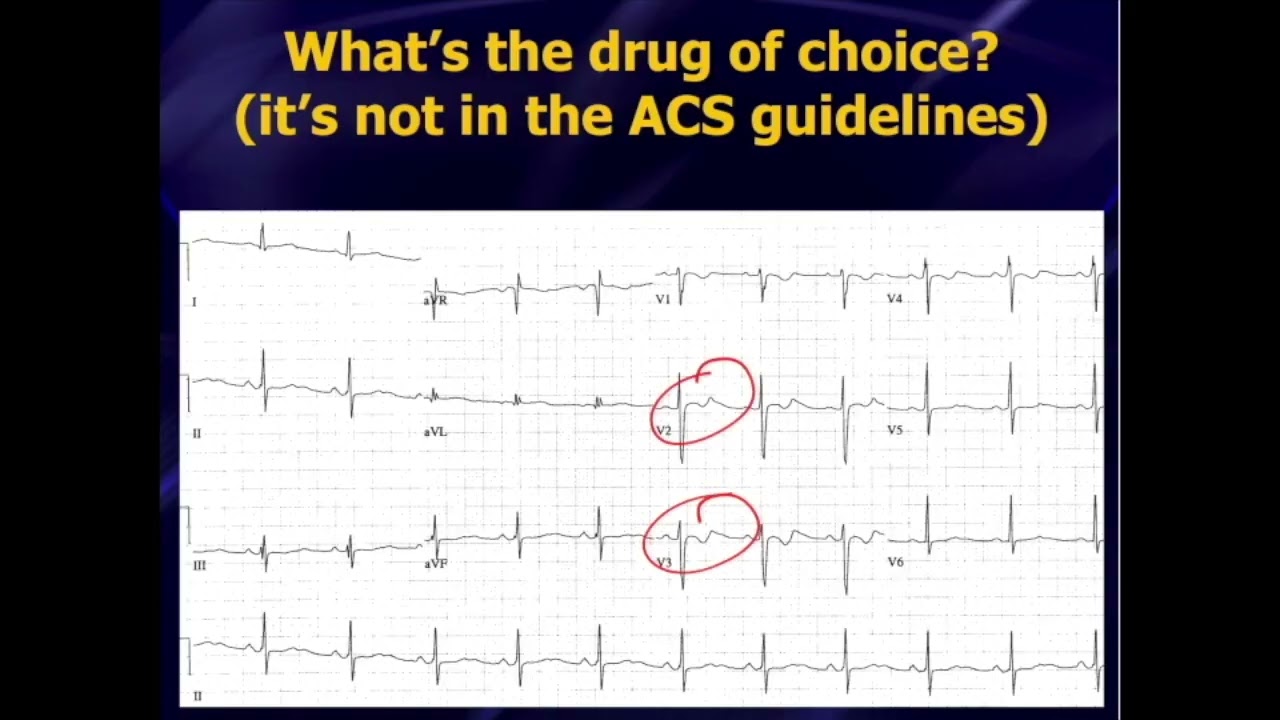 Dr. Amal Mattu's 2-Day Advanced ECG Course - EMCardio.com 2026 Course Preview (Live and Online)