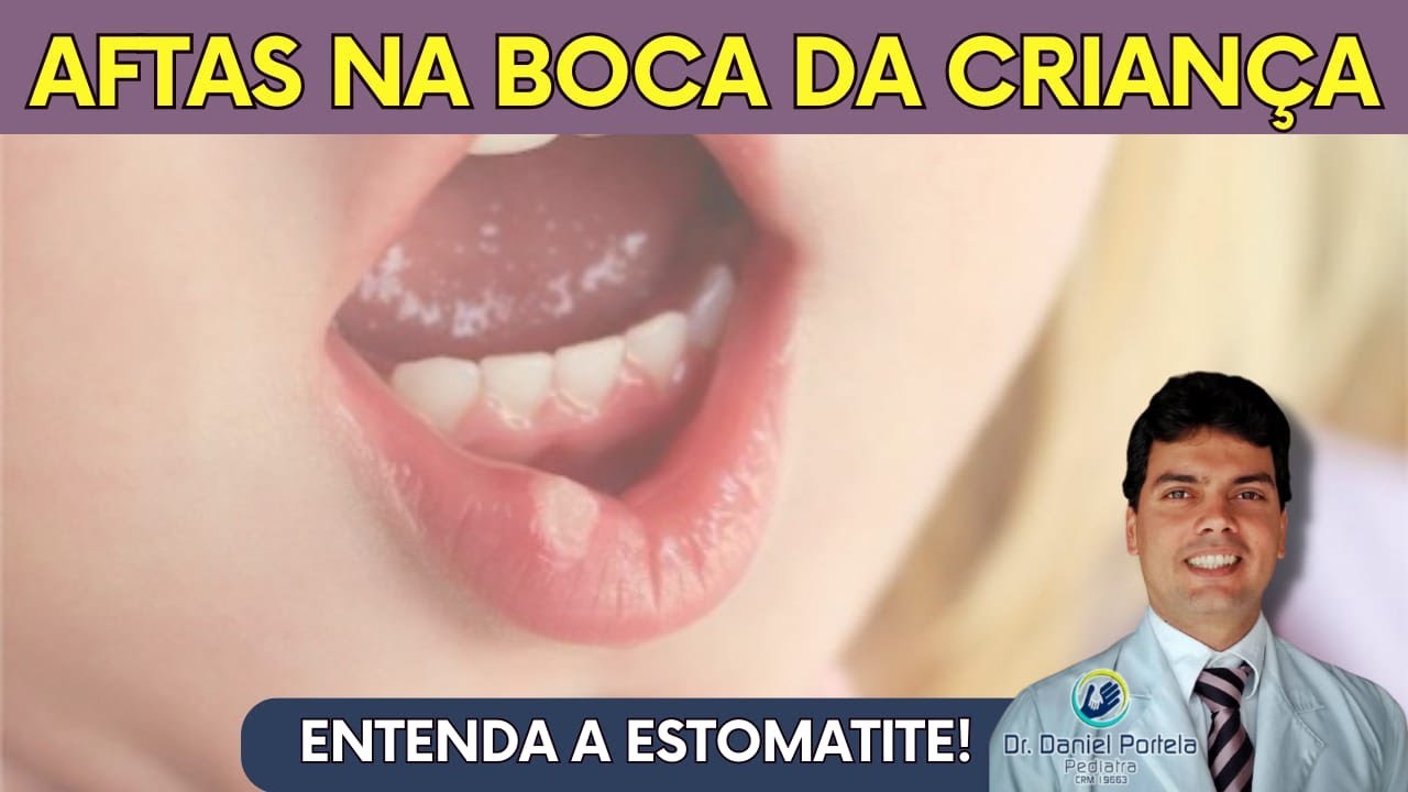 Aftas e feridas na boca da criança (estomatite)