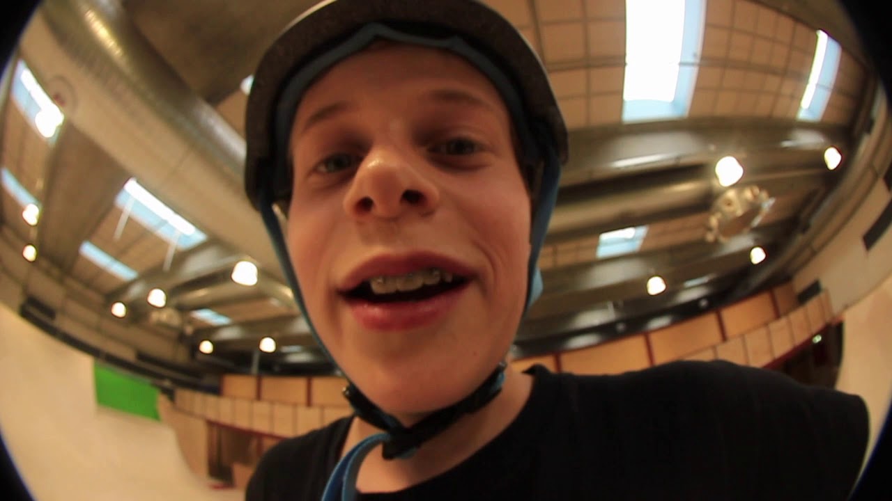 GAME OF SCOOT: HAPPYHJALTE VS DEPPESKID