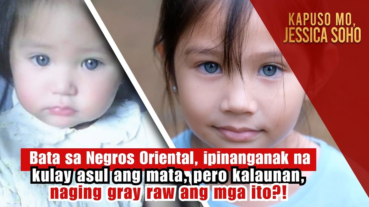 Filipino child reported to have changing eye colors | Kapuso Mo, Jessica Soho